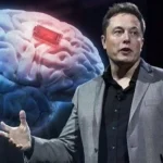 neuralink-cip-nedir